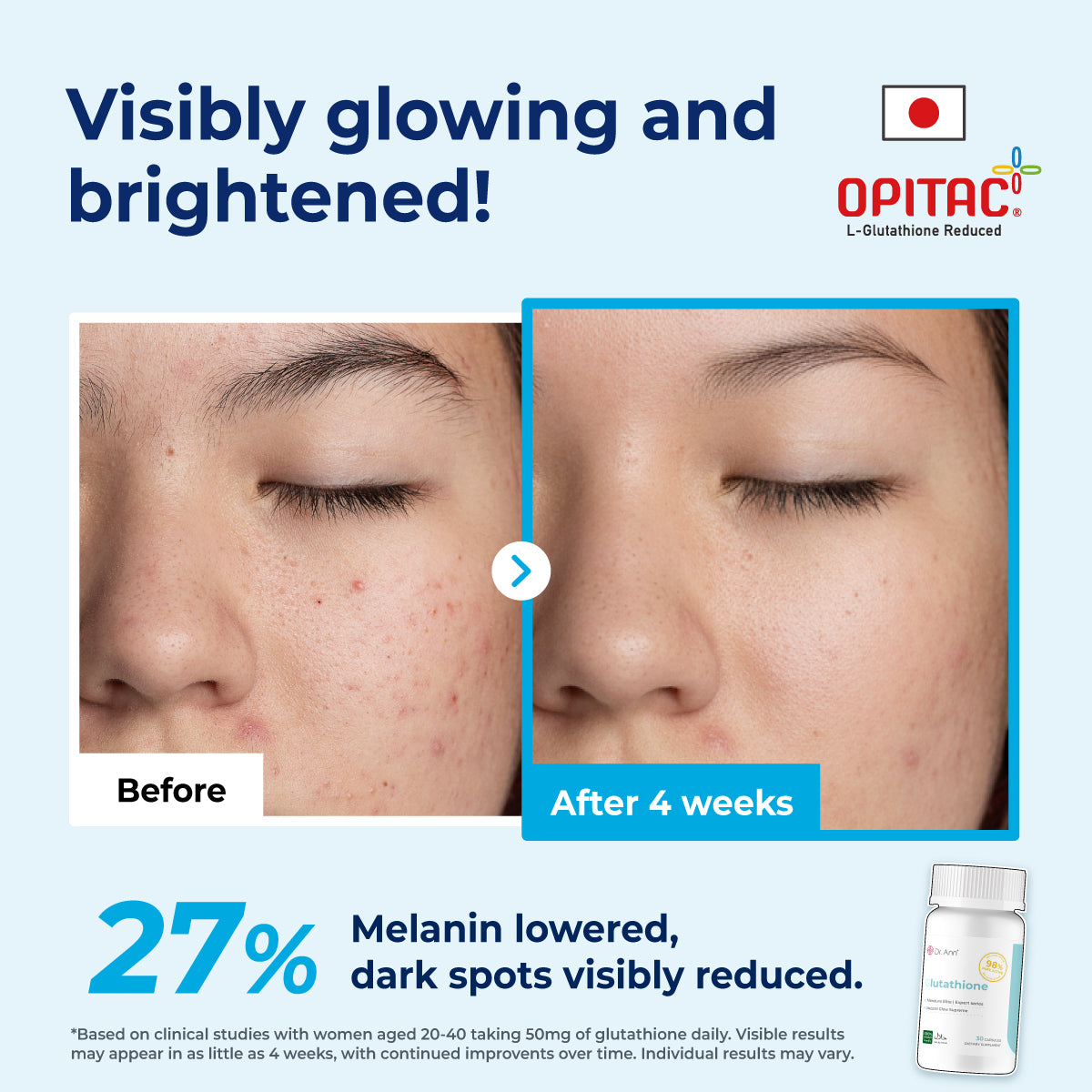 Dr. Ann Glutathione - 30 Capsules