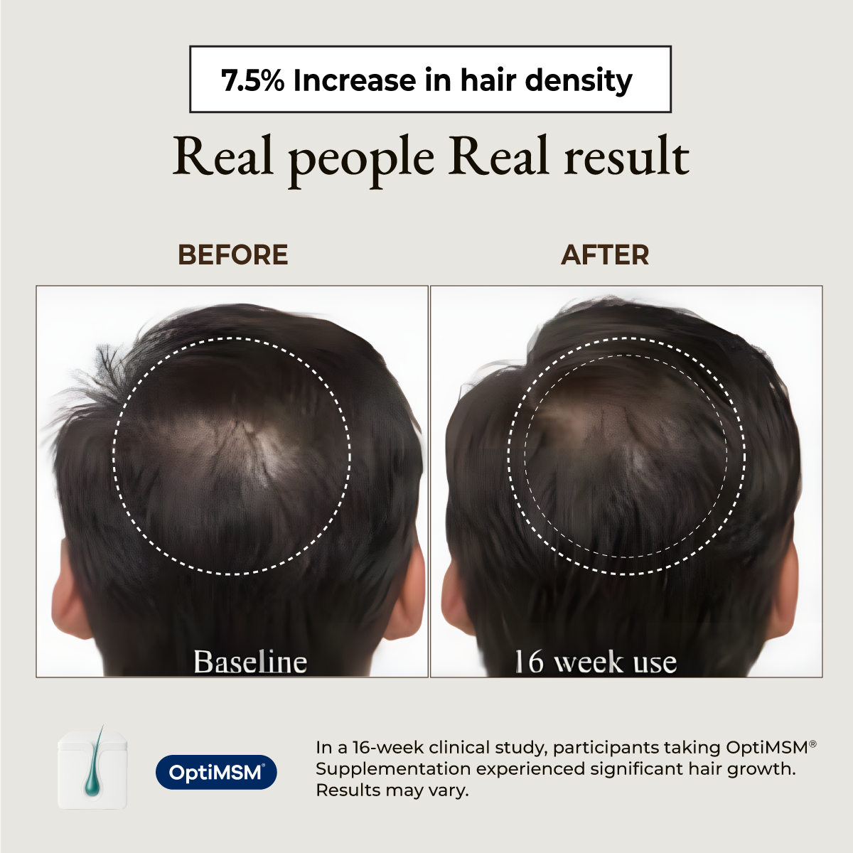 Dr Ann Biotin + OptiMSM® (Hair Architect Formula)
