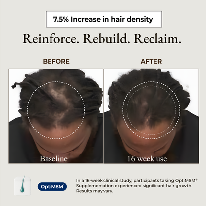 Dr Ann Biotin + OptiMSM® (Hair Architect Formula)
